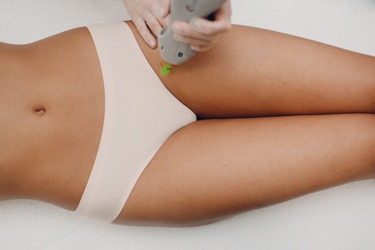 How Much is a Brazilian Laser Hair Removal Session?