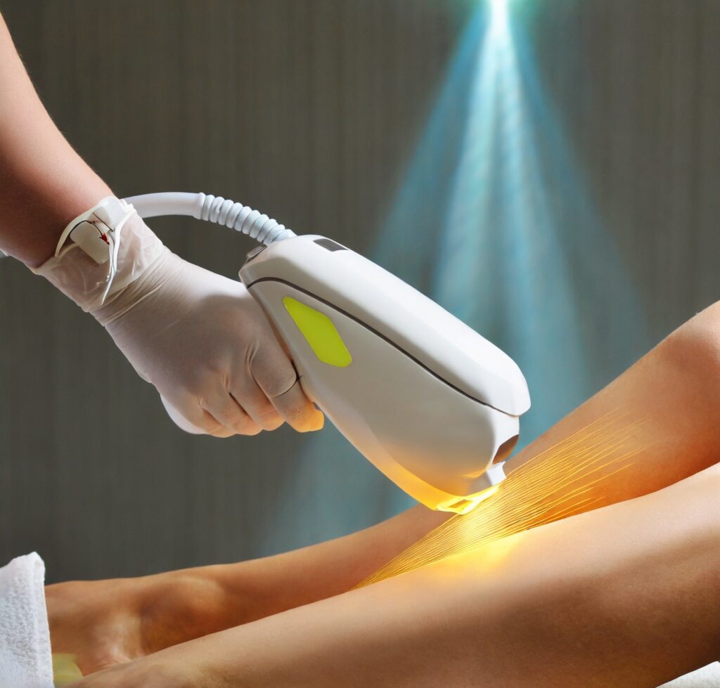 How Much Does a Full Body Laser Hair Removal Cost?